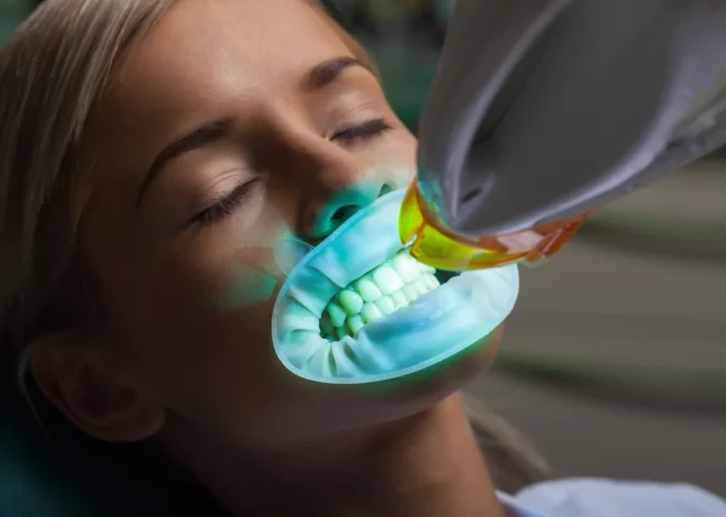 Achieving a Radiant Smile: Comprehensive Guidance on Teeth Whitening in Fargo