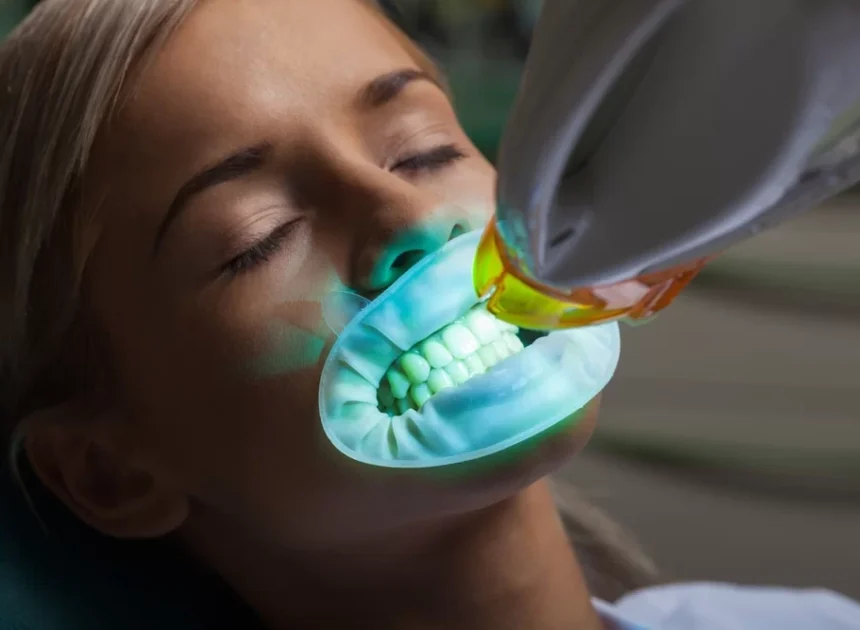 Achieving a Radiant Smile: Comprehensive Guidance on Teeth Whitening in Fargo