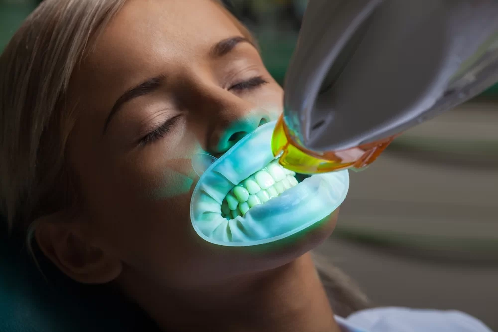 Achieving a Radiant Smile: Comprehensive Guidance on Teeth Whitening in Fargo